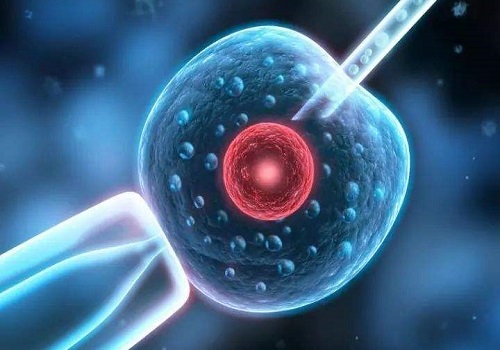 想到俄羅斯做第三代的試管嬰兒要多少的費用