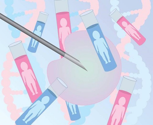 泰國(guó)試管嬰兒優(yōu)勢(shì)